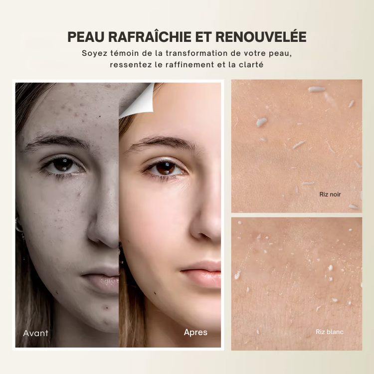 CocoSkin™  UIZ Care Pro - Serum Exfoliant 80ml Riz Blanc ou Noir (Offre Exclusive❤️)