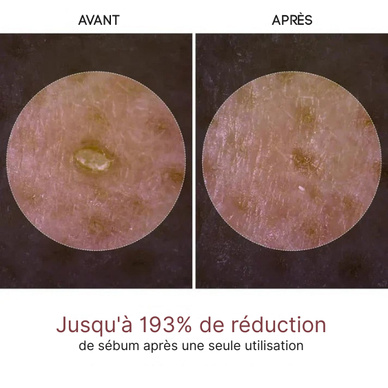 CocoSkin™  UIZ Care Pro - Serum Exfoliant 80ml Riz Blanc ou Noir (Offre Exclusive❤️)