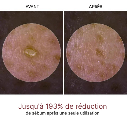 CocoSkin™  UIZ Care Pro - Serum Exfoliant 80ml Riz Blanc ou Noir (Offre Exclusive❤️)