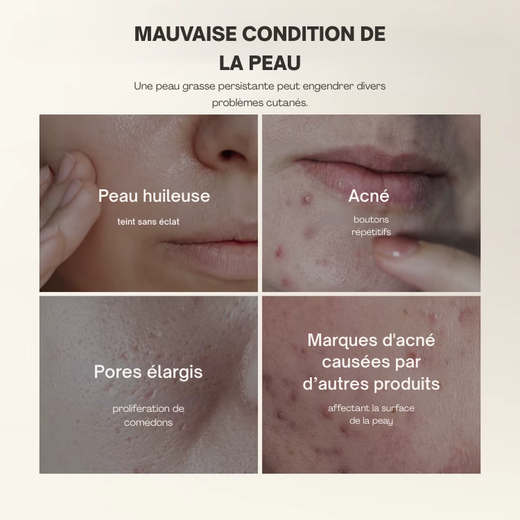 CocoSkin™  UIZ Care Pro - Serum Exfoliant 80ml Riz Blanc ou Noir (Offre Exclusive❤️)