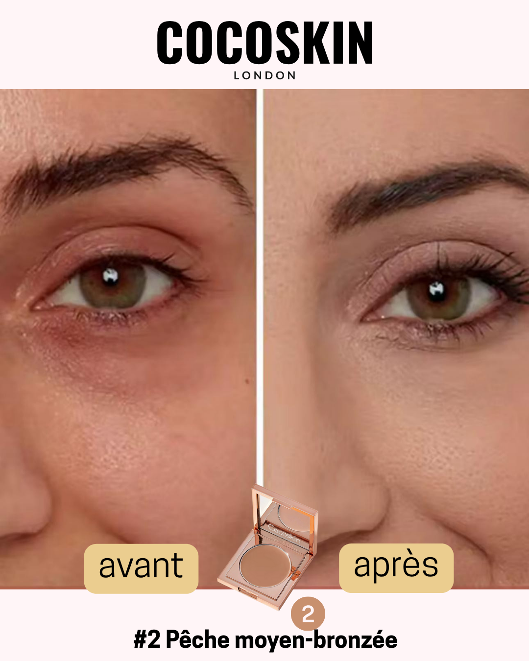 H22 Vitamine E Correcteur-Soin CocoSkin